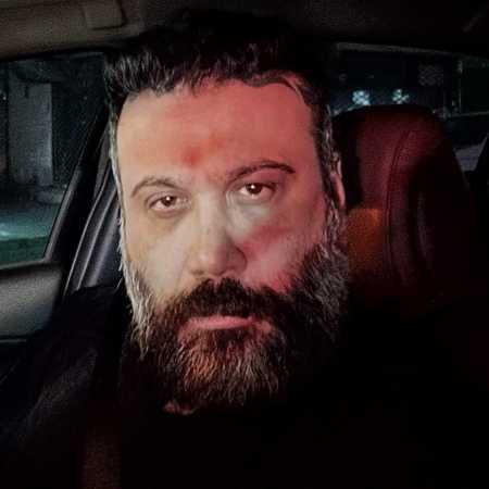 محسن چاوشی زخمی آفتاب